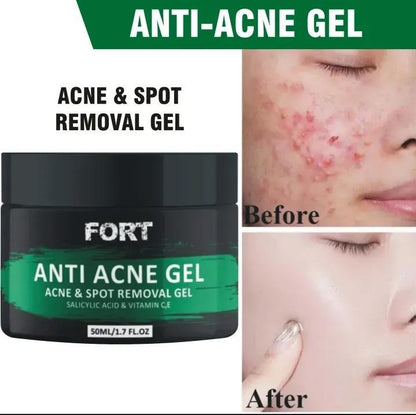 ✨ Fort Acne Scar Removal Exfoliating Gel – Smooth, Clear, Confident Skin
