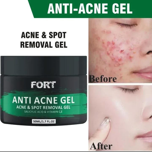 ✨ Fort Acne Scar Removal Exfoliating Gel – Smooth, Clear, Confident Skin