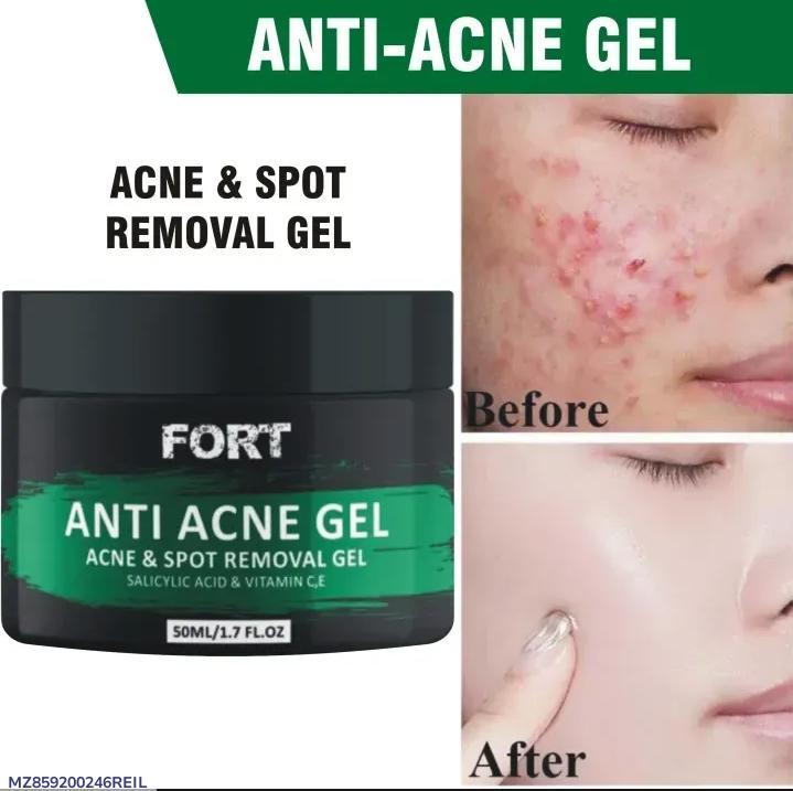 ✨ Fort Acne Scar Removal Exfoliating Gel – Smooth, Clear, Confident Skin