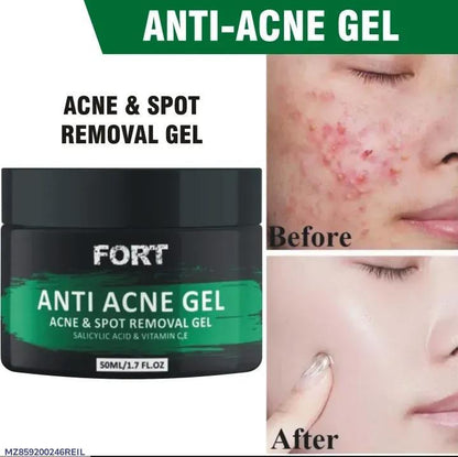✨ Fort Acne Scar Removal Exfoliating Gel – Smooth, Clear, Confident Skin